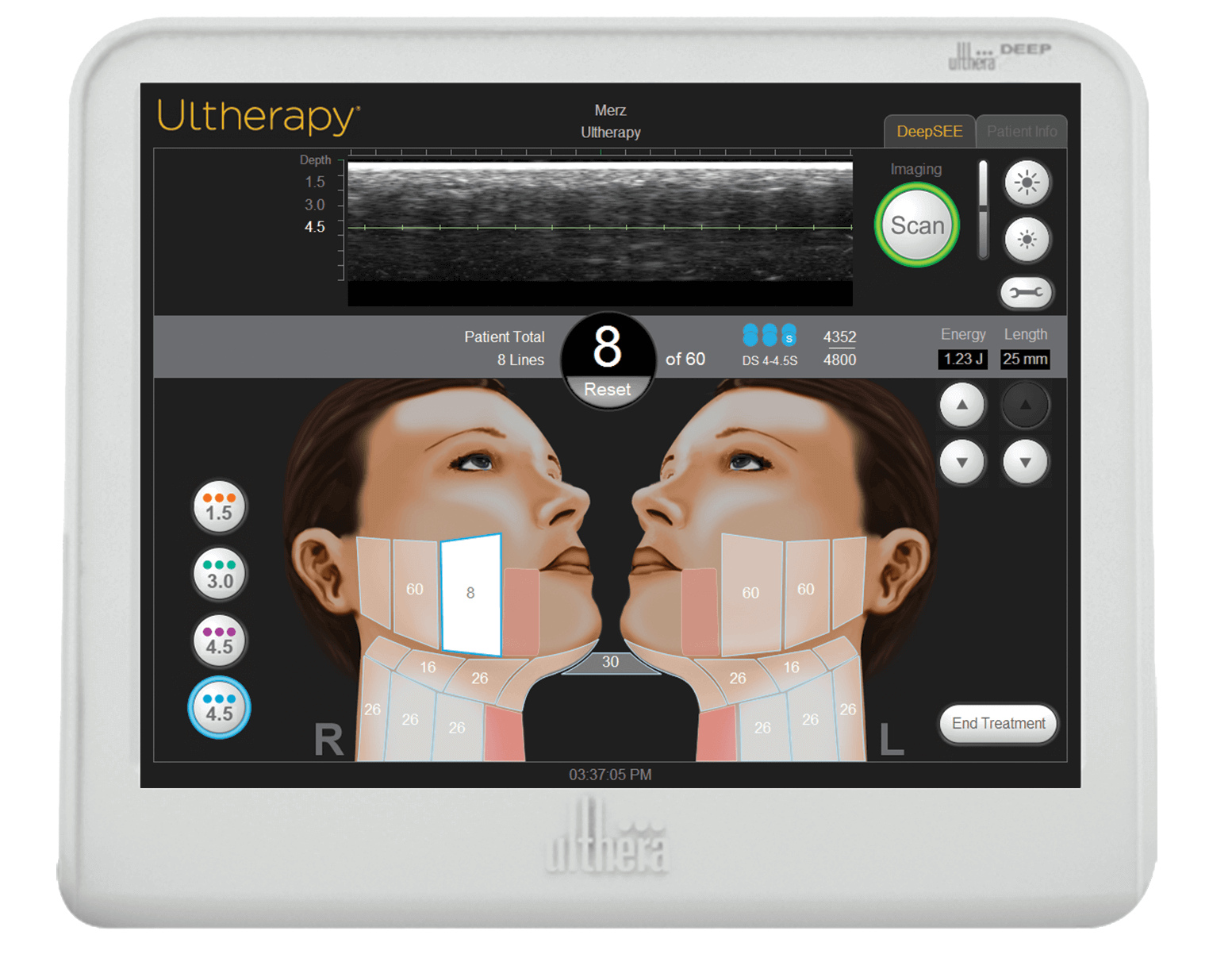 Ultherapy: El Lifting Facial No Invasivo Que Reafirma Tu Piel!