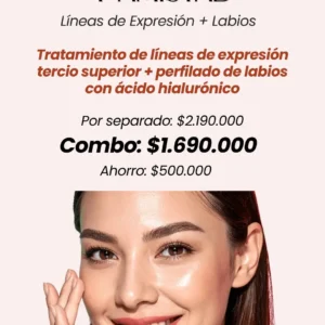 Líneas de expresión + Labios