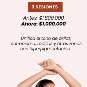 Despigmentación Zonas Oscuras