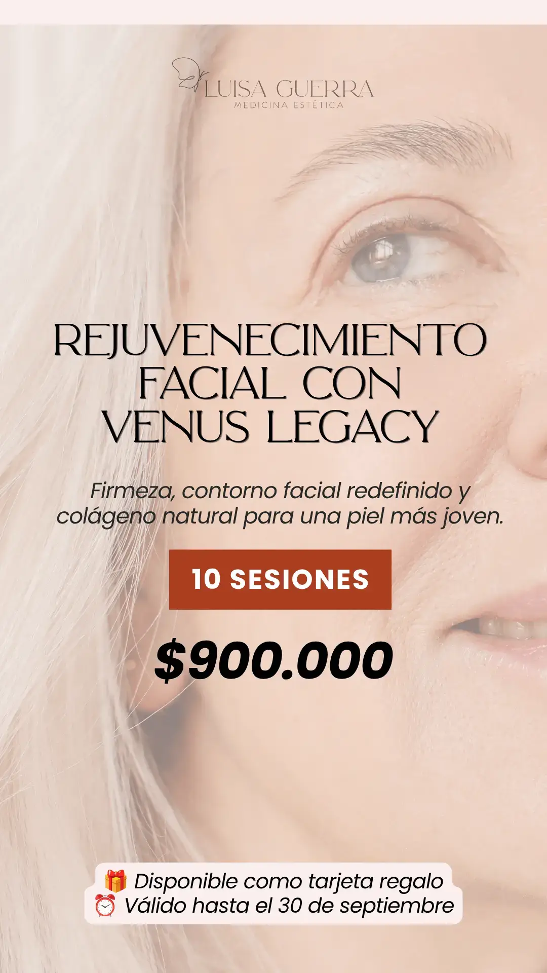 Rejuvenecimiento facial con Venus Legacy