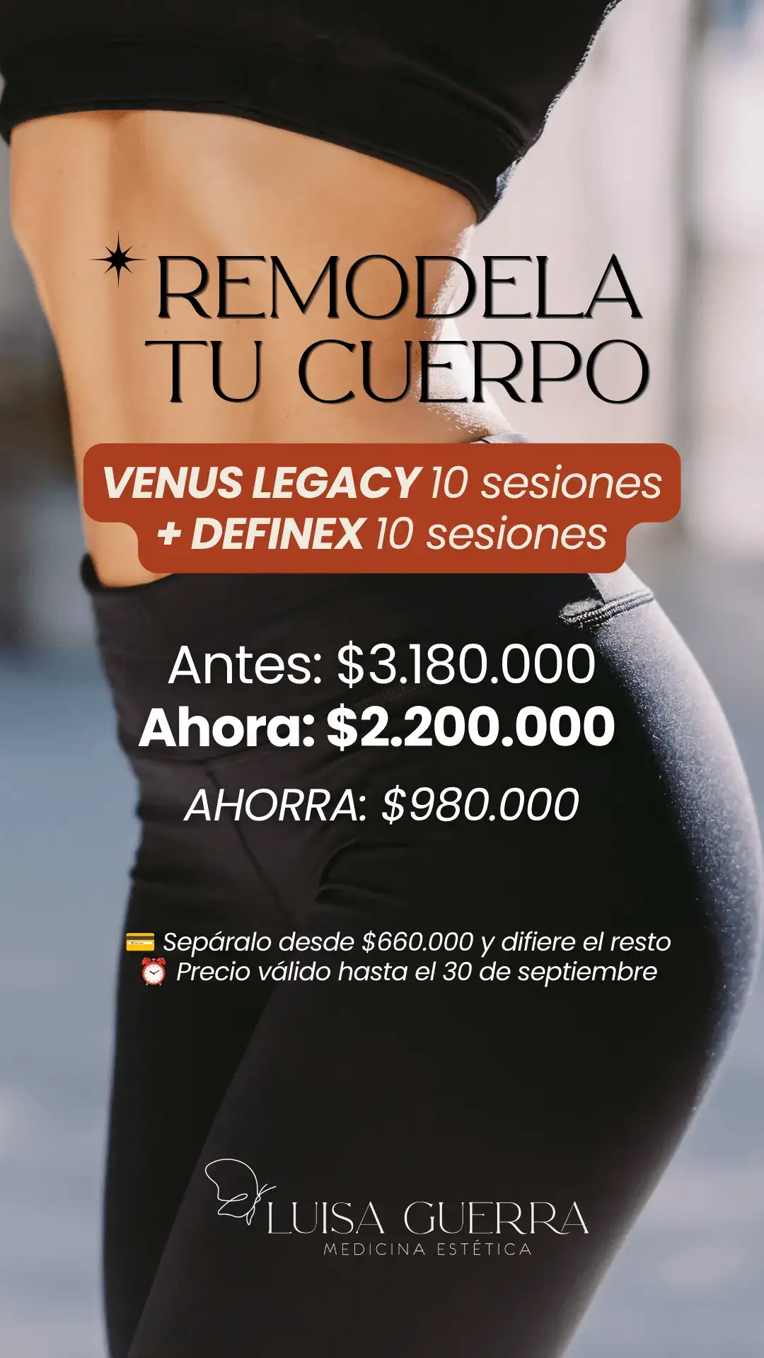 Venus Legacy 10 Sesiones + Definex 10 Sesiones