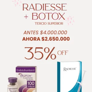 Radiesse + Botox